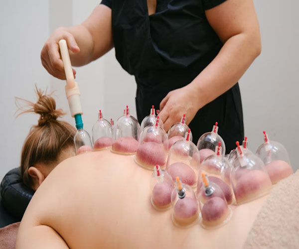 How Cupping Therapy Promotes Pain Relief &
                                    Healing in Gurgaon